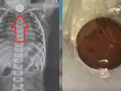 Ilhabela disponibiliza 1 mil doses de vacina contra a gripe no “Dia D”