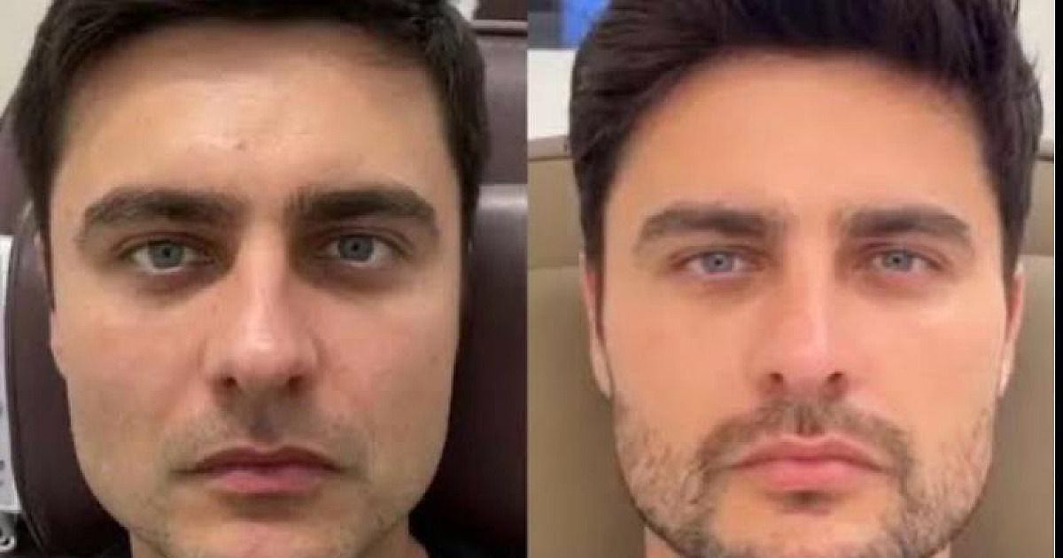 Harmonização facial se consolida como queridinha no mercado da vaidade masculina